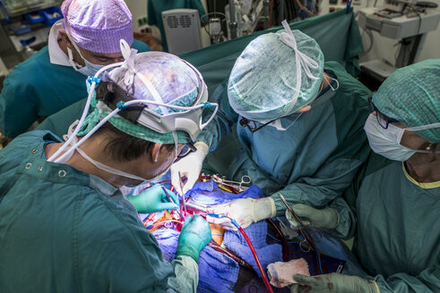 Herzchirurgen und OP-Schwester während einer Herzklappenoperation - MWEF000075