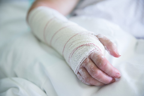 Frau im Krankenhaus, operierte Hand, lizenzfreies Stockfoto