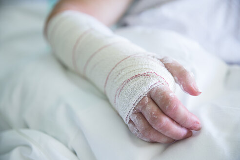 Frau im Krankenhaus, operierte Hand - ERLF000177
