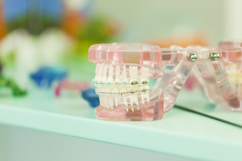 Zahnmodell mit Zahnspange, lizenzfreies Stockfoto