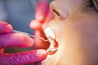 Patieint bei der Behandlung durch den Zahnarzt - ZEDF000232