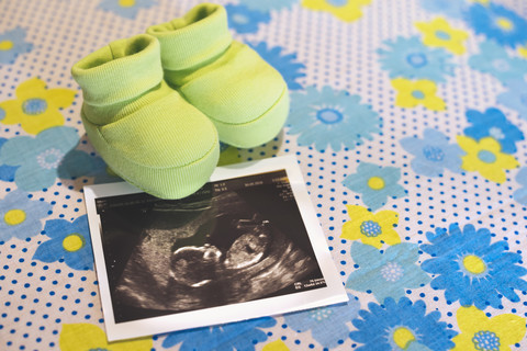 Ultraschall eines kleinen Mädchens und winzige Babyschuhe auf einem geblümten Blatt, lizenzfreies Stockfoto