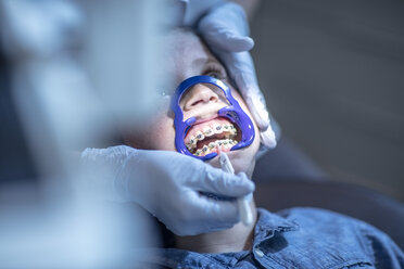 Junge in der Zahnarztpraxis zur kieferorthopädischen Behandlung - ZEF10646