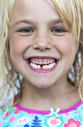 Portrait of little girl showing tooth gap - JFEF00823