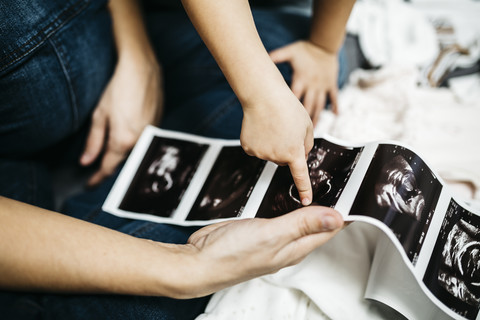 Little boy looking at ultrasound scans of his pregnant mother, partial view stock photo