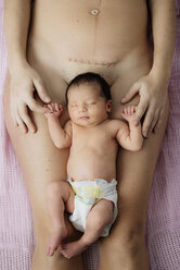 Neugeborenes Mädchen auf den Oberschenkeln der Mutter liegend, in der Nähe einer frischen Kaiserschnittnarbe mit Klammern - GEMF01368