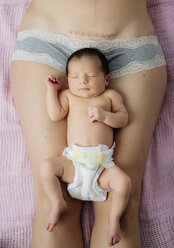 Neugeborenes Mädchen auf den Oberschenkeln der Mutter liegend, in der Nähe einer frischen Kaiserschnittnarbe mit Klammern - GEMF01369