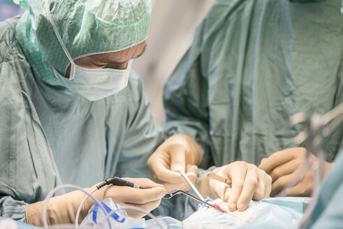 Neurochirurgen öffnen den Schädel während einer Operation - MWEF00111
