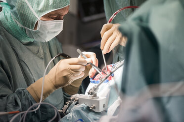 Neurochirurgen öffnen den Schädel während einer Operation - MWEF00112