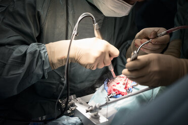 Neurosurgeons opening the cranium during an operation - MWEF00113