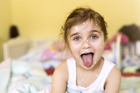 Portrait of girl with chickenpox at home - HAPF01429