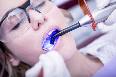Aushärtung von Zahnfüllungen beim Zahnarzt - WESTF22907