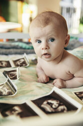 Baby on a blanket with ultrasound pictures of itself - MFF03605