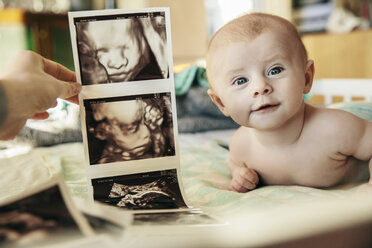 Baby being compared to early 3D ultrasound pictures of itself - MFF03606