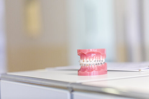 Tooth model with braces in dental surgery - MMAF00204