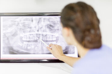 Female dentist examining x-ray of teeth on screen - MMAF00217
