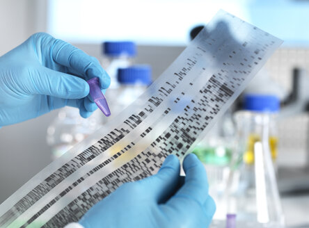 Wissenschaftler mit einer DNA-Probe und den Ergebnissen auf einem Autoradiogramm in einem Labor - ABRF00018