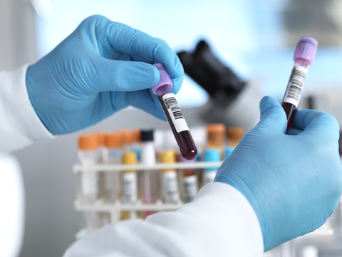 Hand holding blood sample in laboratory stock photo
