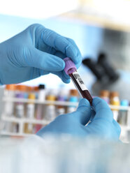Hand holding blood sample in laboratory - ABRF00023