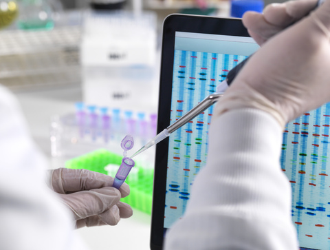 Scientist pipetting a DNA sample with the results on a computer sceeen in a laboratory stock photo