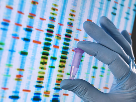 Wissenschaftler mit einer DNA-Probe, deren Ergebnisse auf einem Computer in einem Labor angezeigt werden - ABRF00026