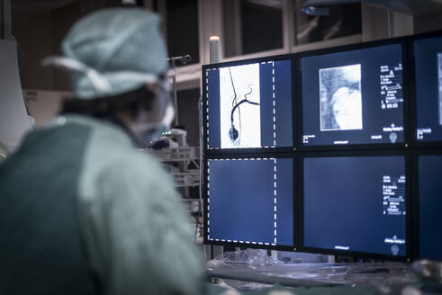 Neuroradiologe im Kittel schaut auf den Monitor - MWEF00175