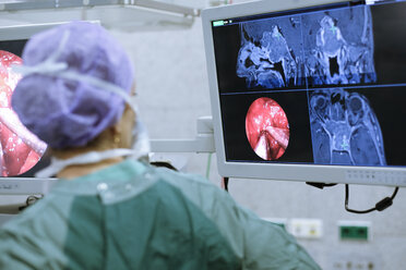 Neurosurgeon in scrubs looking at monitor - MWEF00185