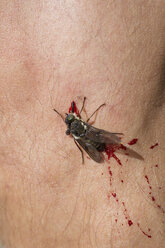 Close-up of dead housefly on skin - FSIF00002