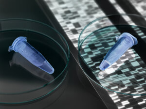 Eppendorf-Fläschchen mit einer menschlichen Probe und den Ergebnissen des DNA-Autoradiogramms - ABRF00093