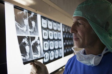 A doctor looking at x-rays on a lightbox - FSIF02928