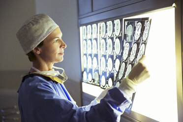 Surgeon reviewing MRI scans - CAIF13351