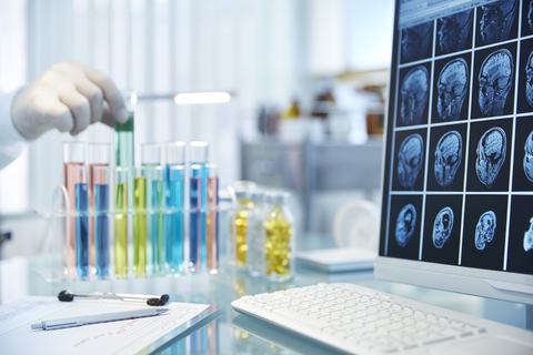 Hand greift nach Fläschchen mit grüner Flüssigkeit, Monitor mit Röntgenstrahlen im Vordergrund, lizenzfreies Stockfoto