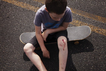 Blick von oben auf einen Jungen mit verletztem Knie, der auf einem Skateboard sitzt - CAVF09882