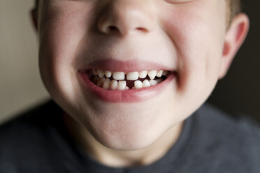 Close-up of boy showing gap toothed - CAVF24427