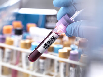 Medical technician preparing a human blood sample for clinical testing - ABRF00134