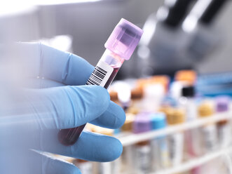 Medizintechniker bei der Vorbereitung einer menschlichen Blutprobe für klinische Tests - ABRF00135