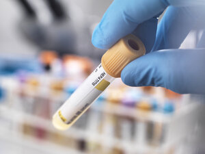 Medizintechniker bei der Vorbereitung einer menschlichen Probe für einen Hepatitis-Test - ABRF00138