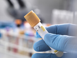Medizintechniker bei der Vorbereitung einer menschlichen Probe für einen HIV-Test - ABRF00139