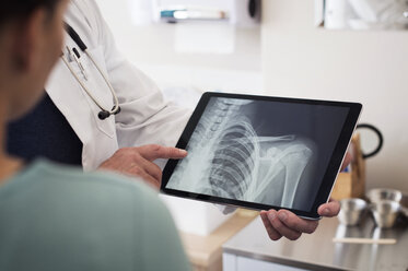 Midsection of doctor showing x-ray image on tablet computer to patient in hospital - CAVF38509