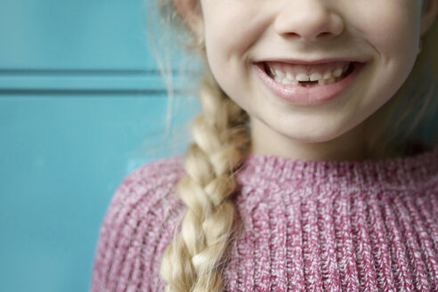 Nahaufnahme eines Mädchens mit fehlenden Zähnen - CAVF45922