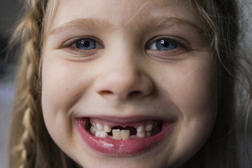 Nahaufnahme eines glücklichen Mädchens mit Zähnen - CAVF46033