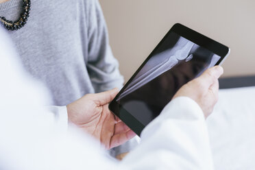 Nahaufnahme eines Arztes, der einem Patienten ein Röntgenbild auf einem Tablet-Computer erklärt - CAVF47516