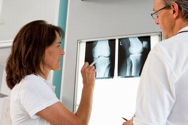 Arzt und Krankenschwester bei der Untersuchung von Röntgenbildern - CUF01115