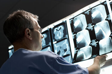 Arzt beim Betrachten von Röntgenbildern - CUF01246