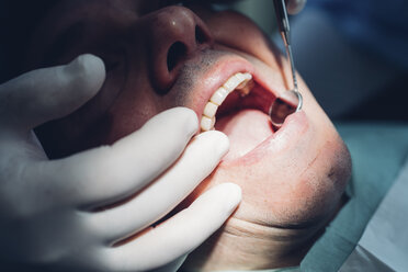 Zahnärztin führt zahnärztliche Behandlung an einem männlichen Patienten durch, Nahaufnahme - CUF03446