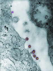 Mikroskopische Vollbildaufnahme von Rötelnvirus-Virionen, die sich von der Oberfläche der Wirtszelle lösen, um in das System des Wirts freigesetzt zu werden, wobei ein umhülltes Viruspartikel entsteht - CUF06136