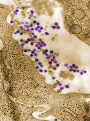 Mikroskopische Vollbildaufnahme von Rötelnvirus-Virionen, die sich von der Oberfläche der Wirtszelle lösen, um in das System des Wirts freigesetzt zu werden, wobei ein umhülltes Viruspartikel entsteht - CUF06137