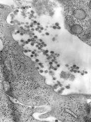 Negativ gefärbte transmissionselektronenmikroskopische Aufnahme von Rötelnvirus-Virionen, die sich von der Oberfläche der Wirtszelle lösen, um in das Wirtssystem freigesetzt zu werden, wobei ein umhülltes Viruspartikel entsteht - CUF06144