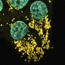 Mikroskopische Aufnahme von mutierten menschlichen Epithelzellen - CUF06147