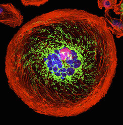 Mikroskopische Aufnahme einer polyploiden Riesenkrebszelle - CUF06157